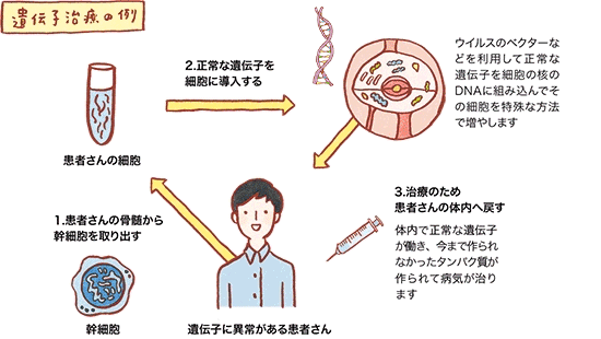 遺伝子治療の例の図