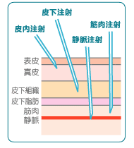 皮下 注射 筋肉 注射 違い