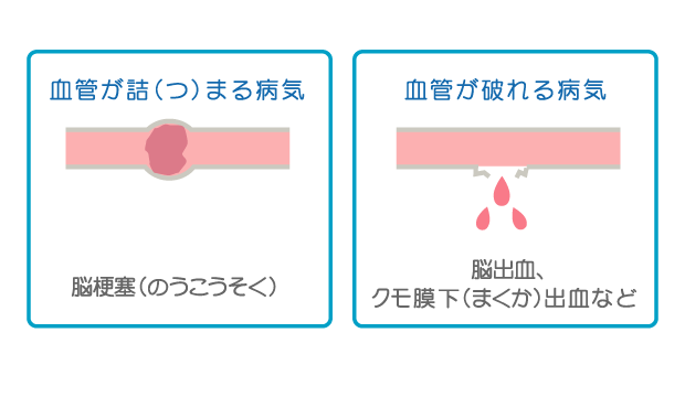 脳 からだとくすりのはなし 中外製薬