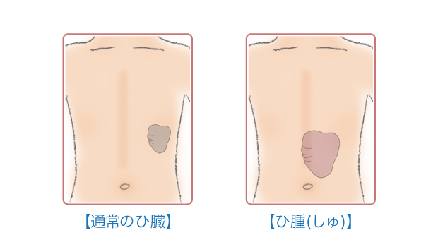 いらない 脾臓 【医学】人体の“無駄な器官”、実は有用でした…虫垂・扁桃体・脾臓・胸腺・尾骨