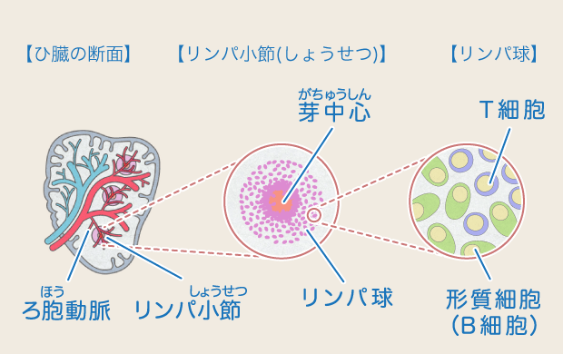 いらない 脾臓 脾臓がない患者の感染症予防