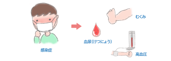 じん臓の機能が低下