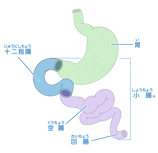 十二指腸 閉鎖 ダウン症 じゃ なかっ た