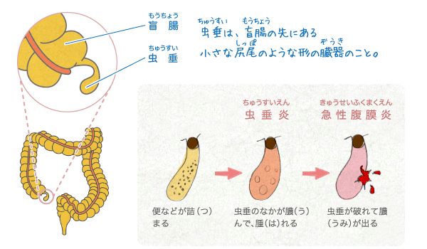 盲腸