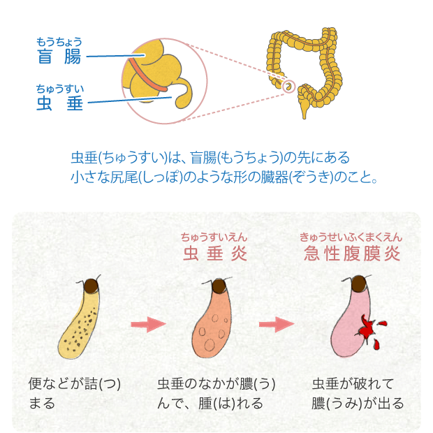 大腸 からだとくすりのはなし 中外製薬