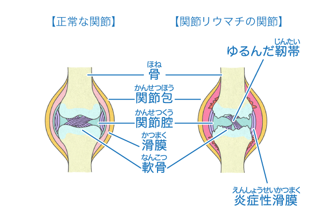 関節 からだとくすりのはなし 中外製薬
