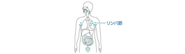 リンパ節