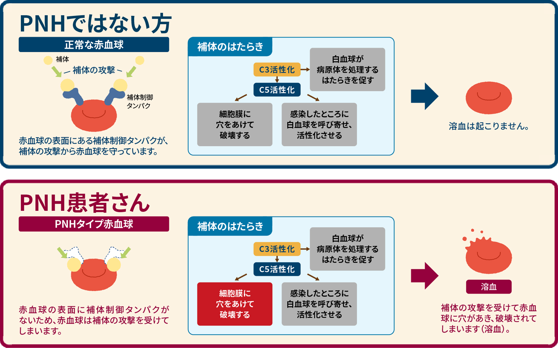PNHタイプ赤血球の溶結機序