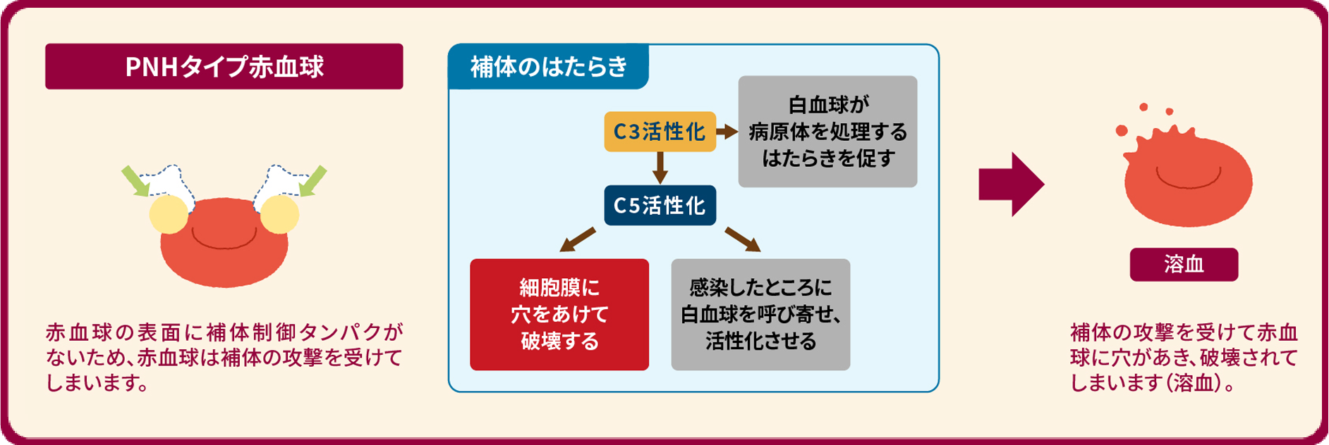 PNHタイプ赤血球の溶結機序