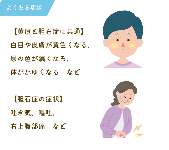 黄疸（おうだん）、胆石症